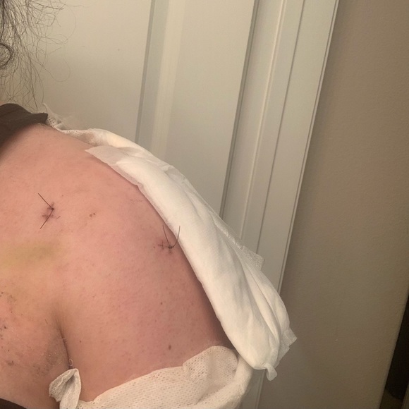 Waiting on next specialist🧿Malpractice Complications🧿 - Picture 7 of 11